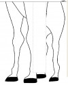 Boy Grafiği 4